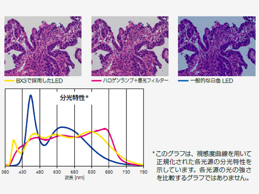 Bright LED Lighting Optimized for Pathology and Cytology