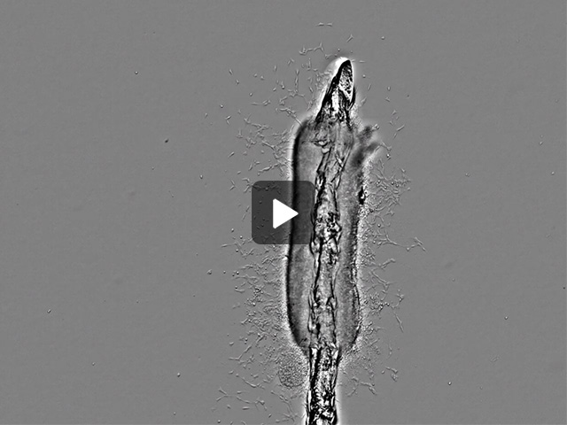 Migration of ENCDCs from E6 chick midgut