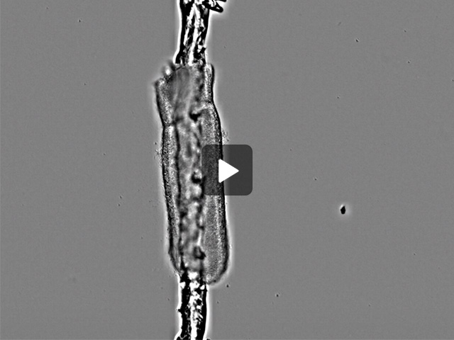 Live cell imaging recordings of E6 chick midgut explants