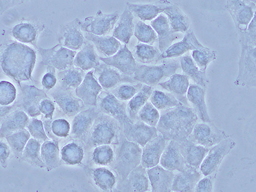 HeLa cells