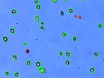 MEF：Murine embryonic Fibroblasts