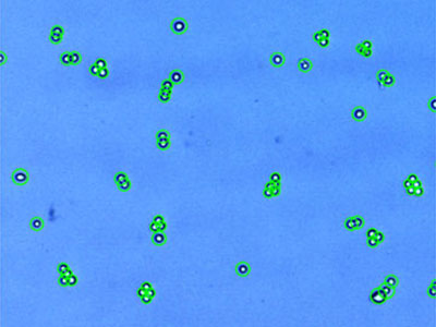 293-GFP： HEK293 stably expressing GFP