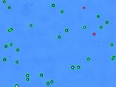 Hep3B： Human hepatocellular carcinoma