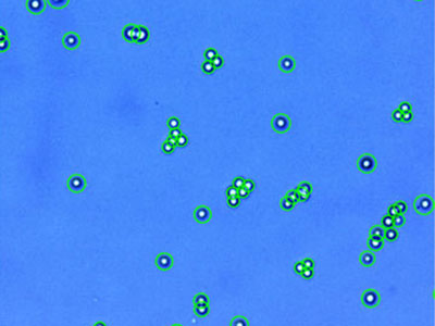 PANC-1： Human pancreatic ductal carcinoma