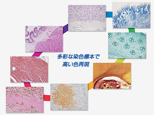 さまざまな染色標本で高色再現性を実現