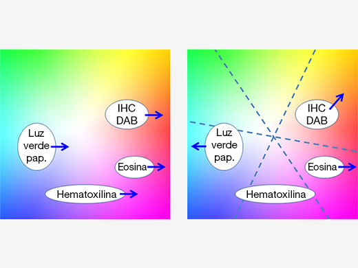 Figura 5 - Con ajuste de color tradicional, (izquierda) el realce de rojo para eosina afecta a los otros colorantes, mientras que el ajuste de color multieje (derecha) permite conseguir una optimización independiente de los colores para cada colorante