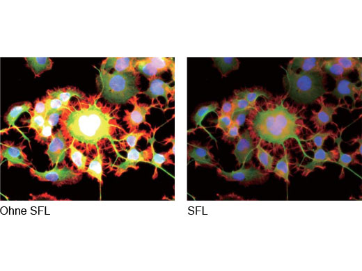 Korrekte Belichtung dank Optimierung im SFL-Modus (Super-Fluoreszenz)