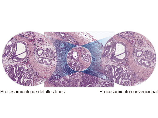 Procesamiento de detalles finos para una resolución superior