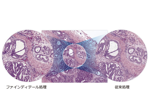 偽色やモアレを抑えるファインディテール処理