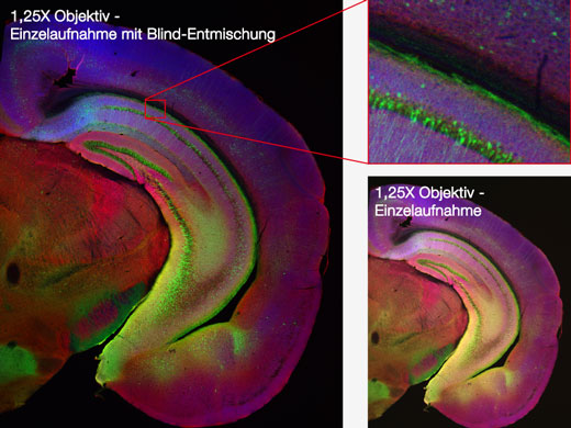 Makro- und Mikro-Imaging und Mikroskopie mit Superauflösung