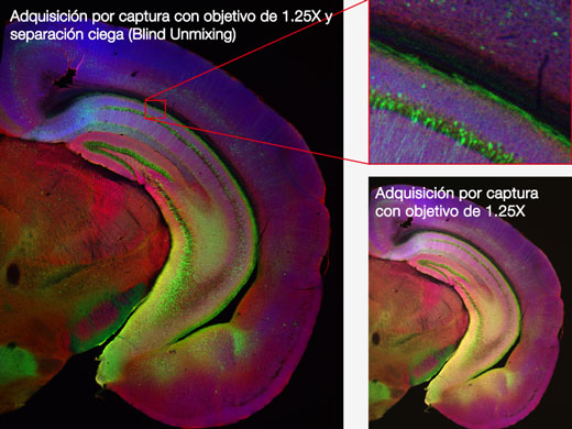 Imágenes de nivel macro a micro y súper resolución