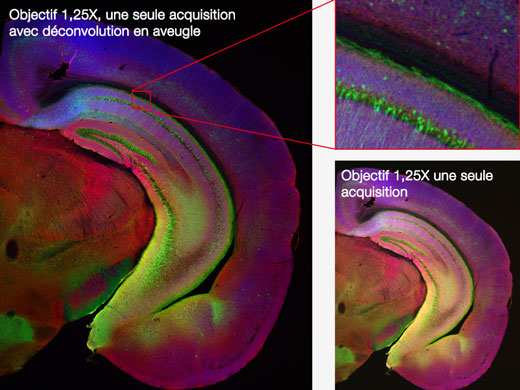 Imagerie macro à micro et microscopie Super Resolution