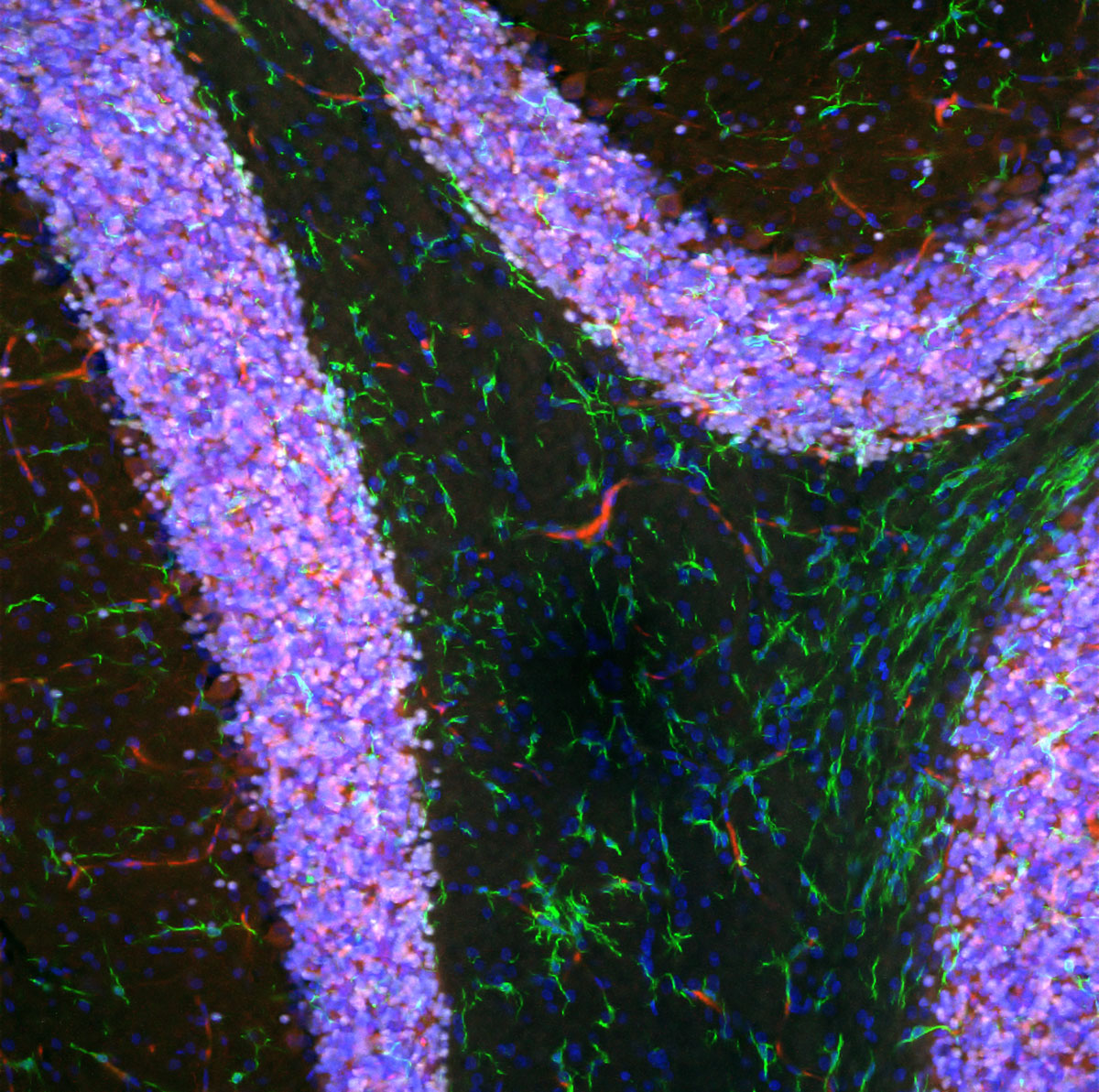 ズームインしてTruSightデコンボリューションを適用した画像