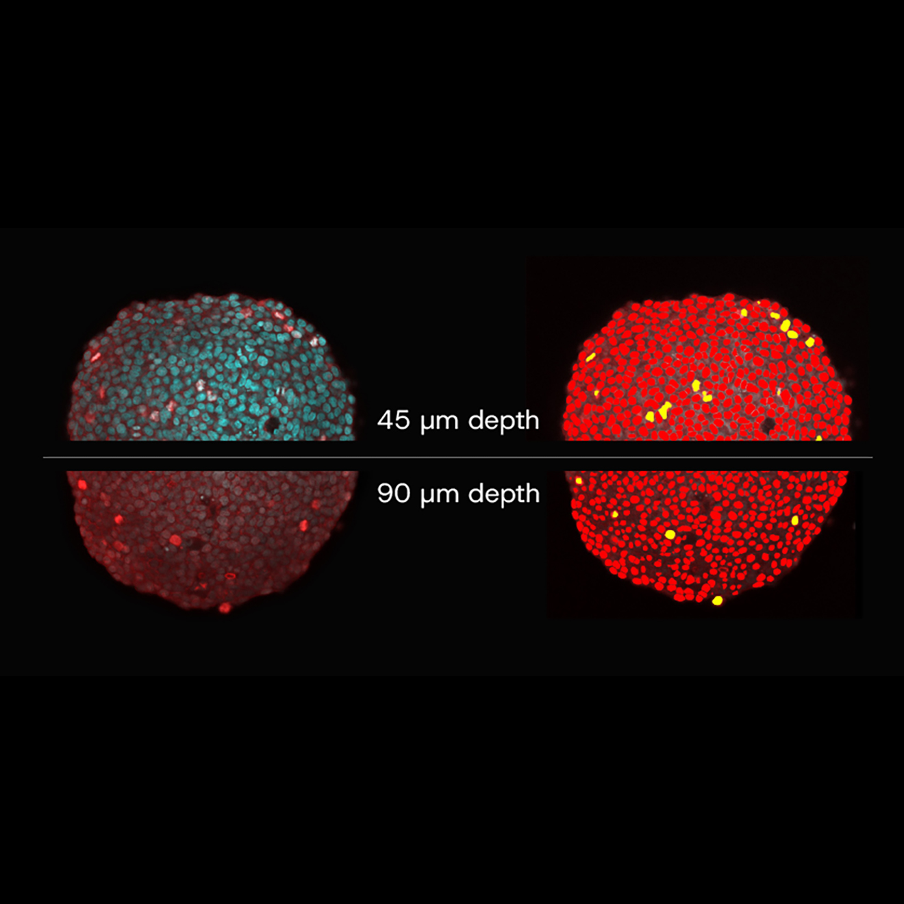 Spheroid imaging and analysis with TruAI. Left: Without TruAI. Right: With TruAI. 