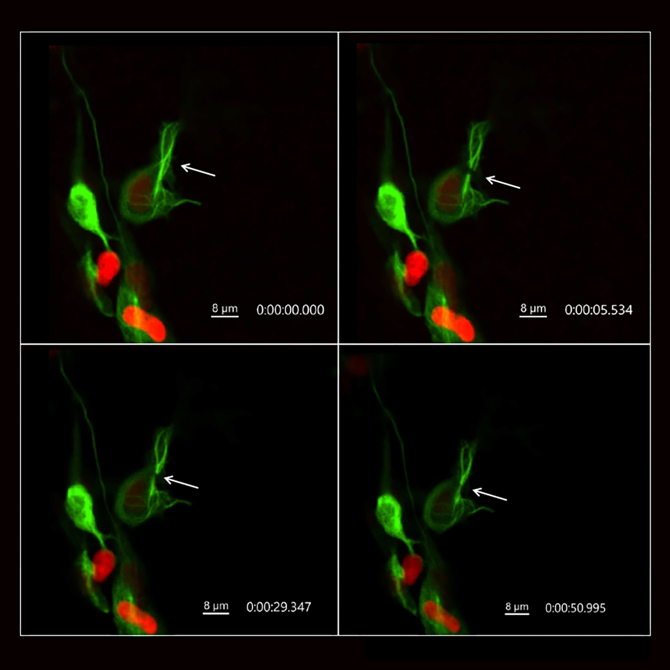 Time-lapse sequence in a living zebrafish embryo. 