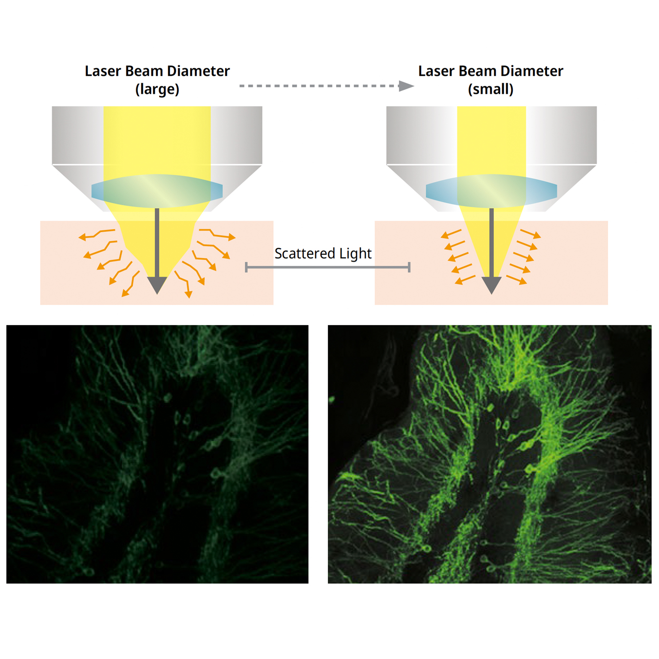 Comparison of a normal image and a Deep Focus image captured using the FLUOVIEW FV5000MPE multiphoton laser scanning microscope.