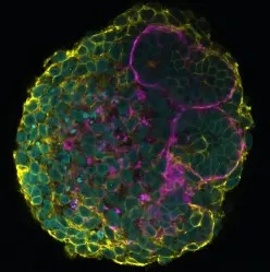 Human iPSC-derived kidney organoids with membrane-GFP.