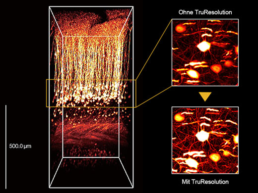 Hochempfindliches, hochauflösendes Deep Imaging mit Multiphotonen-Technologie