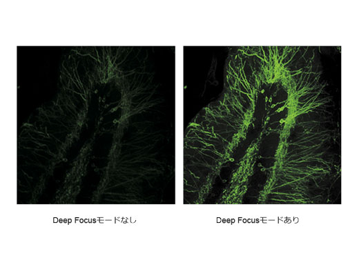 散乱が大きい標本で集光性能をアップする - Deep Focusモード