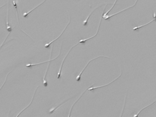 Morphological evaluation of sperm in high magnification 2x