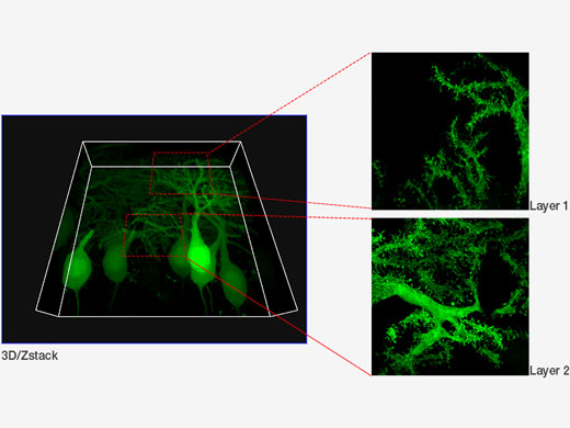 Purkinje cells labeled with GFP. XYZ image with confocal and super resolution image in different Z positions. Super resolution images are projected by Z (10 slices). 3D displayed by FV31S-DT.