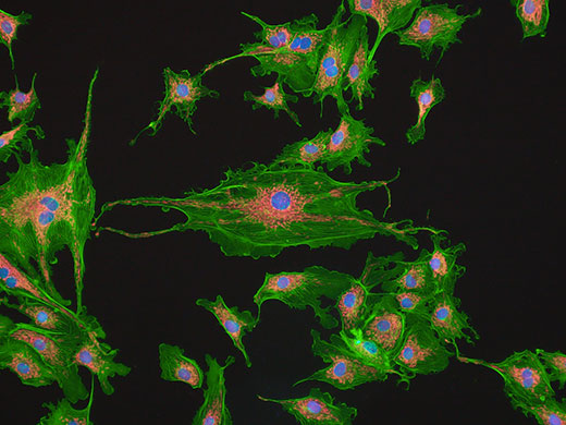 BPAE cells with MitoTracker Red CMXRos, Alexa Fluor 488 Phalloidin, and DAPI.