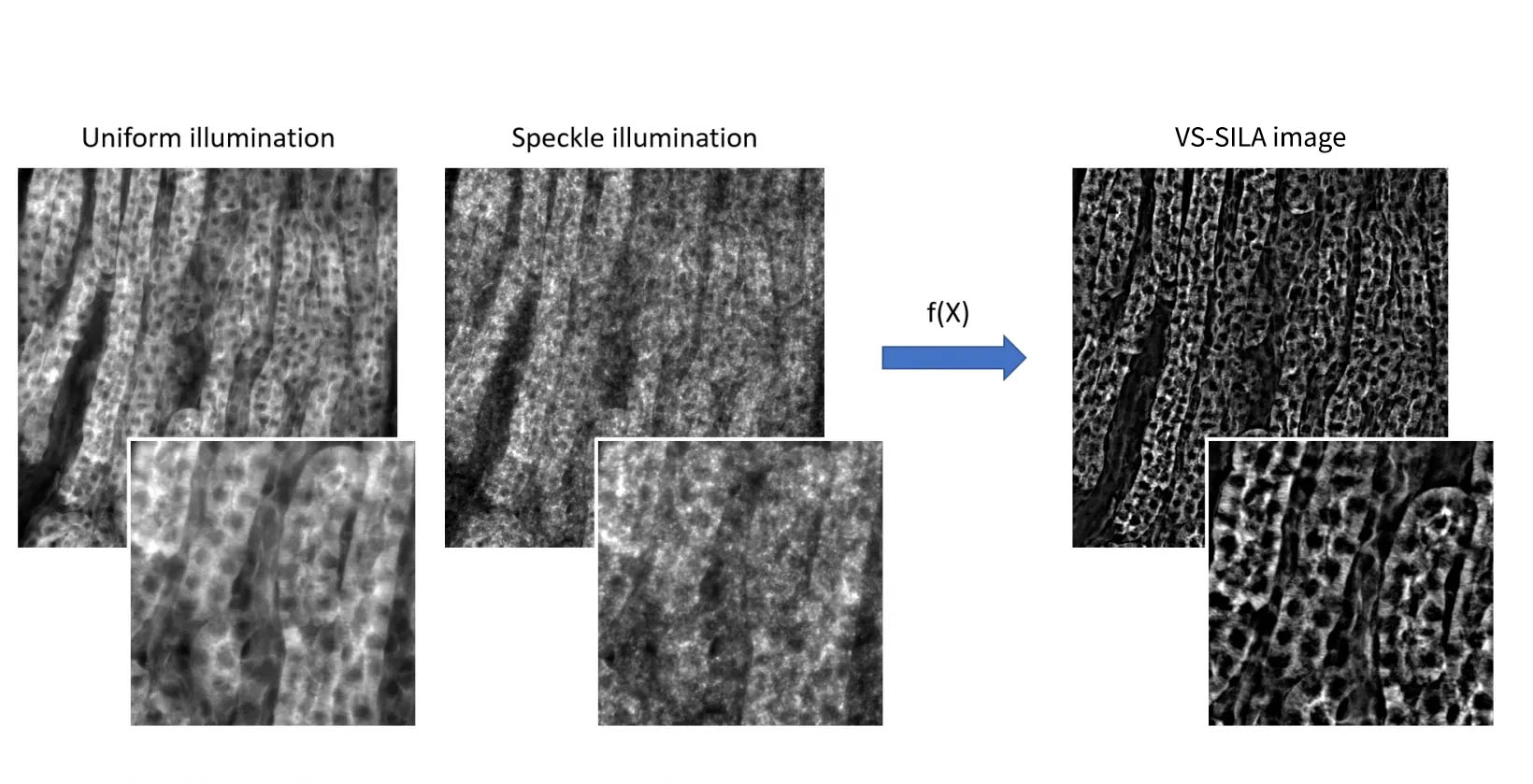 Fast Processing with the Ability to Visualize Optically Sectioned Images in Live View