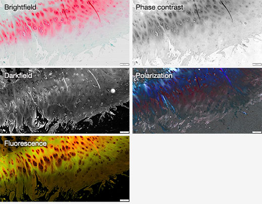 Various observation methods, and an overlaid image with DF and FL