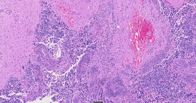 SLIDEVIEW VS200 for Digital Pathology