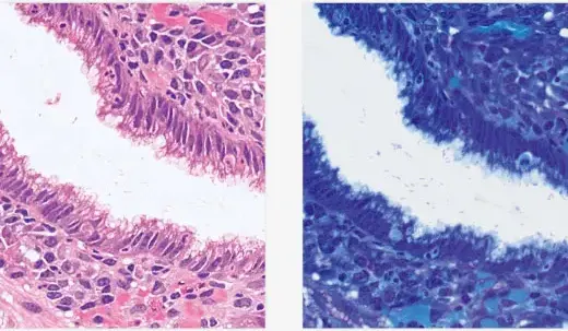 5D Experiment Acquisition