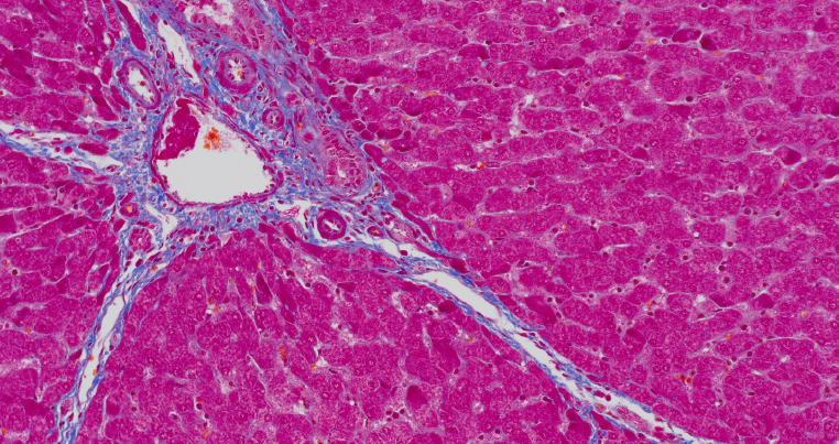 使用 DP28 相机采集的染色猪肝显微镜图像。