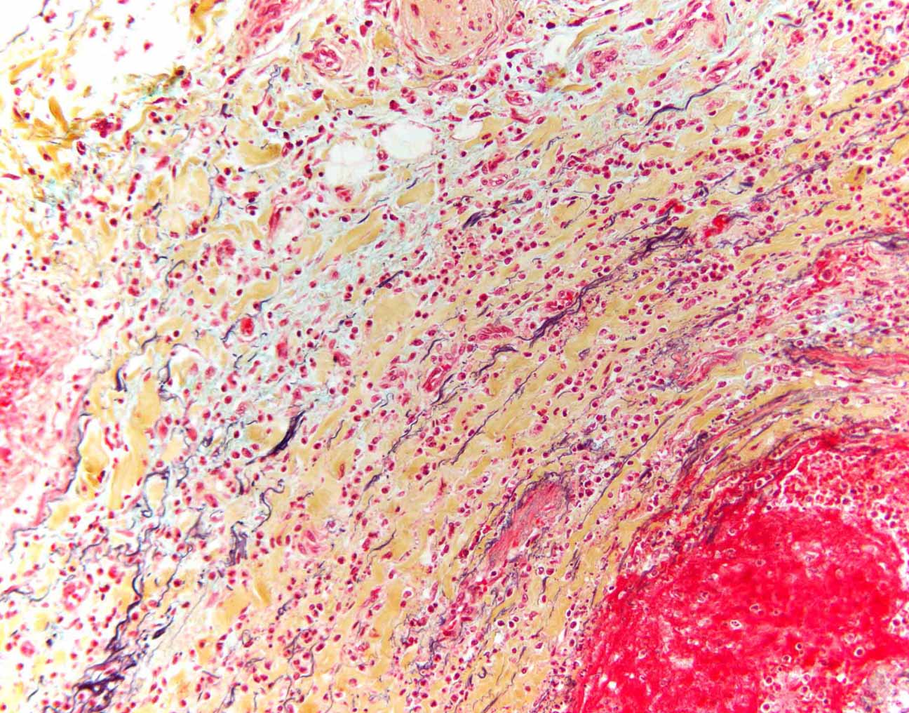 显微镜下显示的血管五色染色