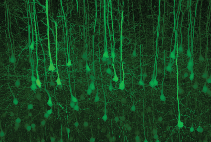 Mouse brain slice cleared with SeeDB2. EYFP cortical layer 5 pyramidal neurons in Thy1-YFP-H.