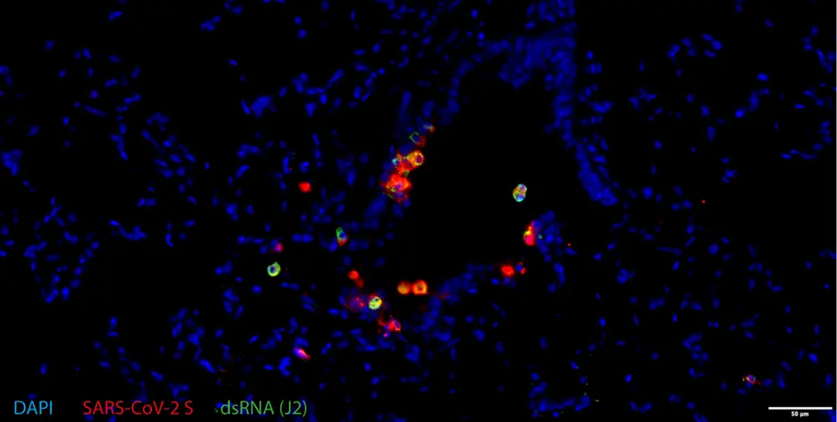  Double-stranded RNA and SARS-CoV-2 spike protein expression in hamster tissue, imaged with the SLIDEVIEW VS200 slide scanner. 