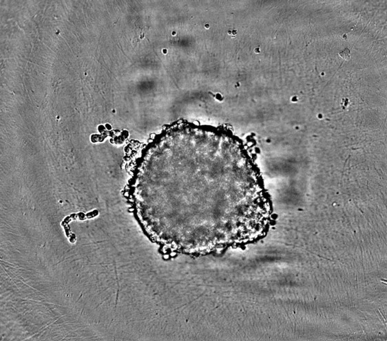 PreComb’s 3D microtumor generated from the HCT116 cell line.
