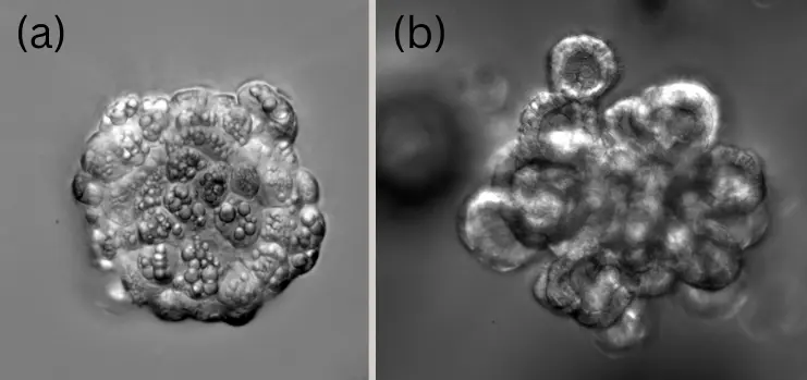 Gradient contrast imaging of hepatocyte organoids captured using the APX100 microscope