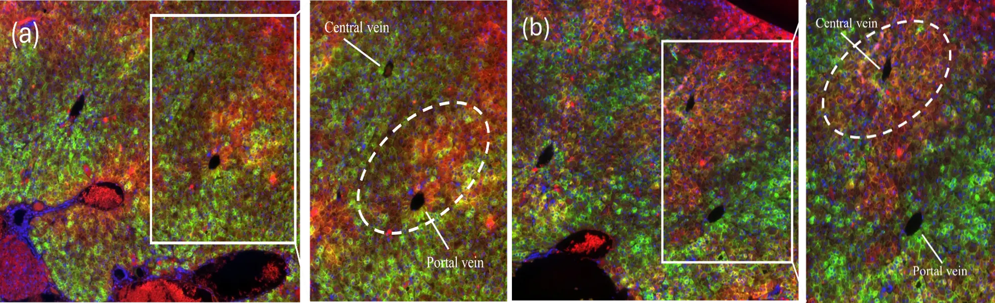 Human hepatocyte organoids (HHOs) transplanted into mouse liver differentiated and established the liver's zonation structure. Images courtesy of Professor Toshiro Sato, Keio University School of Medicine