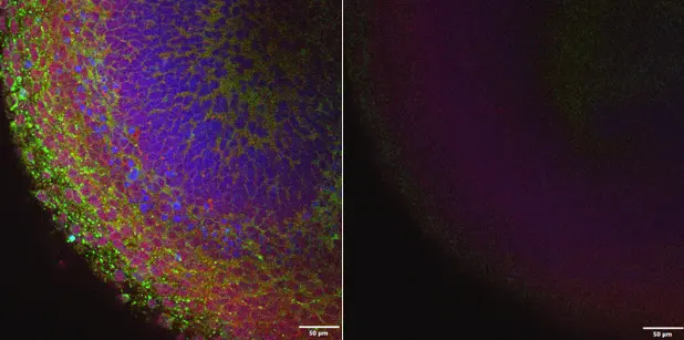 Contact loss with a silicone oil immersion objective causes image brightness/quality loss