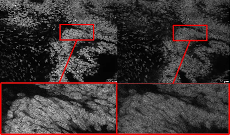 Dry objective image comparison before and after using a silicone oil immersion objective