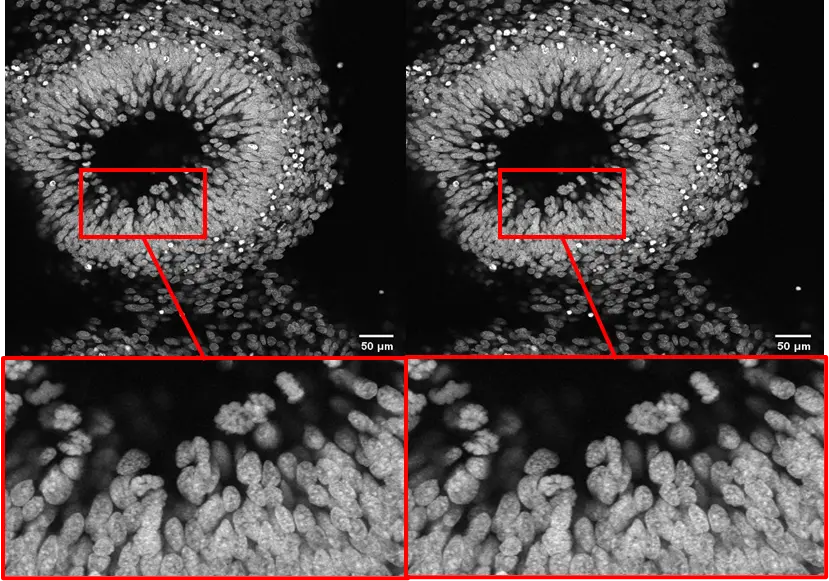 Figure 4. Dry objective image comparison before and after using the silicone gel immersion objective.