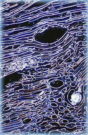 dark field illumination of silkworm larva spiracle and trachea