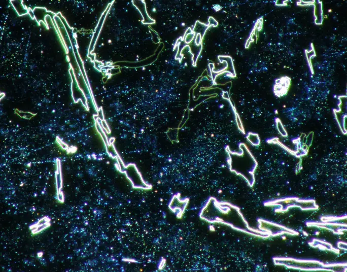 dark field illumination of silkworm larva spiracle and trachea