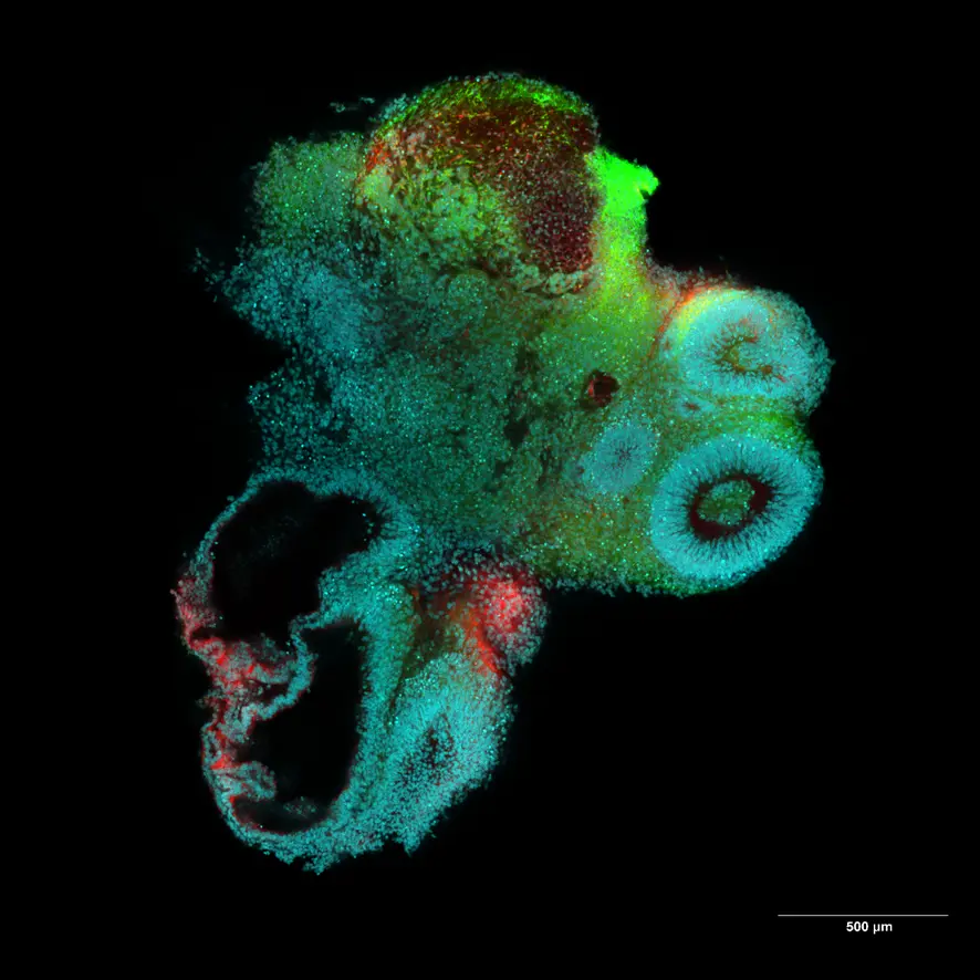Overcoming the Challenges of Organoid Imaging Using a Silicone Gel Immersion Objective