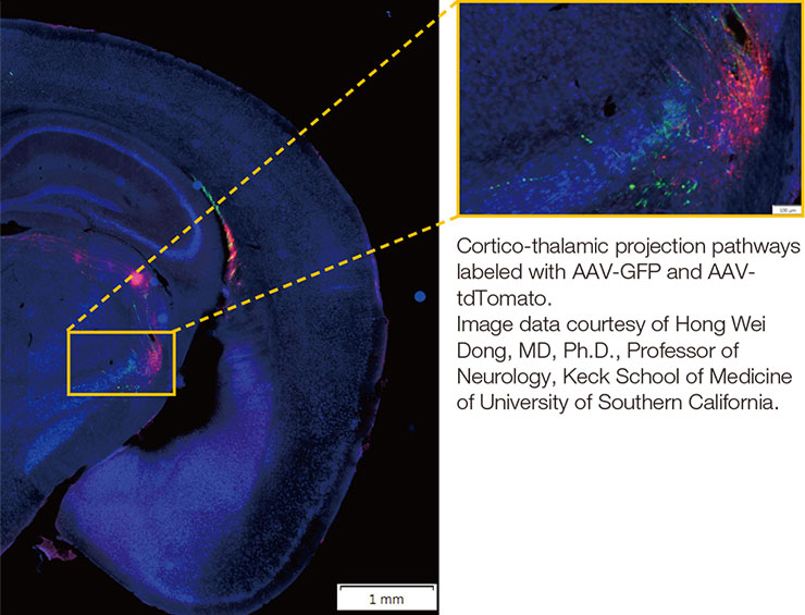 The VS200 slide scanner zoom in brain image