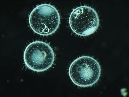dark field microscopy image of Arachnoidiscus ehrenbergi