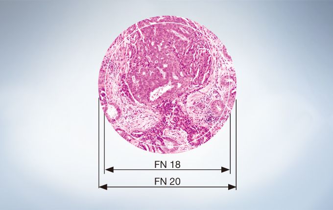 显示FN 18和FN 20两种不同大小视场差别的组织标本显微镜图像。FN代表视场数，也就是目镜的光圈尺寸（单位为毫米），同时决定了标本的成像区域。