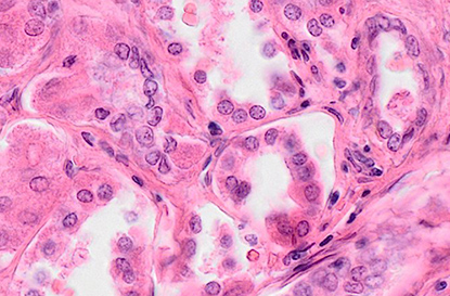 VS200