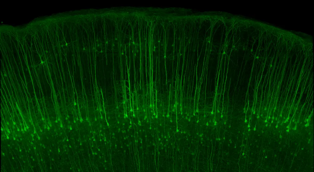 Evident is setting a new standard in life science imaging with its launch of the new FLUOVIEW™ FV5000 confocal and multiphoton laser scanning microscope