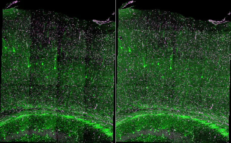 Figure 4. Stitched confocal image of a cleared mouse brain without shading correction (left) and with Intelligent Shading Correction (right). Magenta (DAPI): nuclei. Green (EGFP): neuro cells. Captured on the FLUOVIEW FV4000MPE. Sample courtesy of Sinjun Lab. Co., Taiwan.
