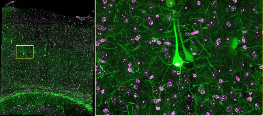 Figure 5. Z-projection image (right) acquired from the yellow rectangle area (left) in the seamlessly stitched image of Figure 4, right. This close-up image shows clear details of nuclei (magenta, DAPI) and neuro cells (green, EGFP) within a cleared mouse brain. TruSight processed to improve the contrast and sharpness of the image. Sample courtesy of Sinjun Lab. Co., Taiwan.